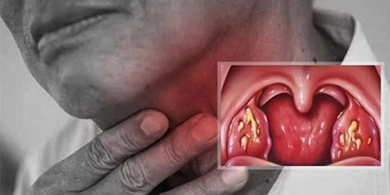 bệnh lý về họng