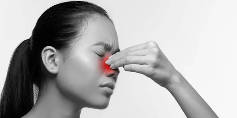 nguyên nhân gây viêm xoang