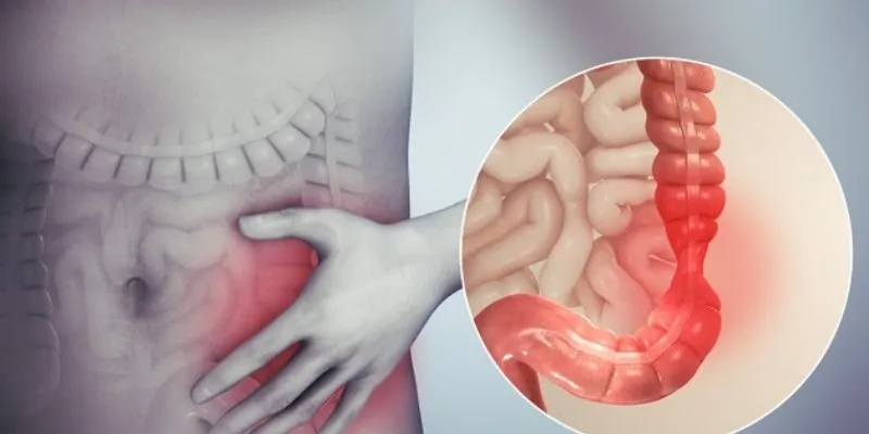 Cách ứng phó với 6 bệnh dễ tấn công bạn khi đợt mưa rét đang tràn về