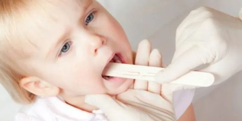 Cách chữa viêm họng cho trẻ